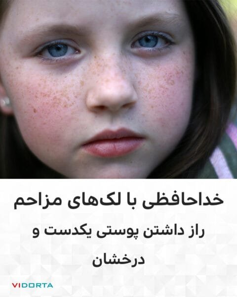 خداحافظی با لک‌های مزاحم؛ راز داشتن پوستی یکدست و درخشان!
