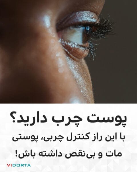 پوست چرب؟ با این راز کنترل چربی، پوستی مات و بی‌نقص داشته باش!